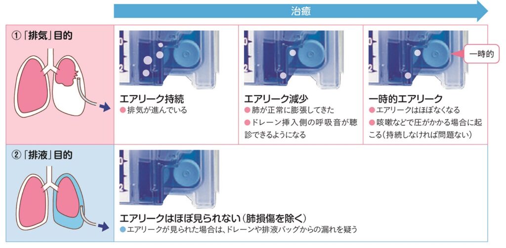 水封室のエアリークの変化（正常の状態）