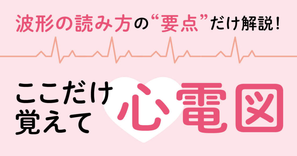 心室期外収縮（PVC・VPC）の心電図の読み方と見分け方を図解で解説 | エキスパートナースweb
