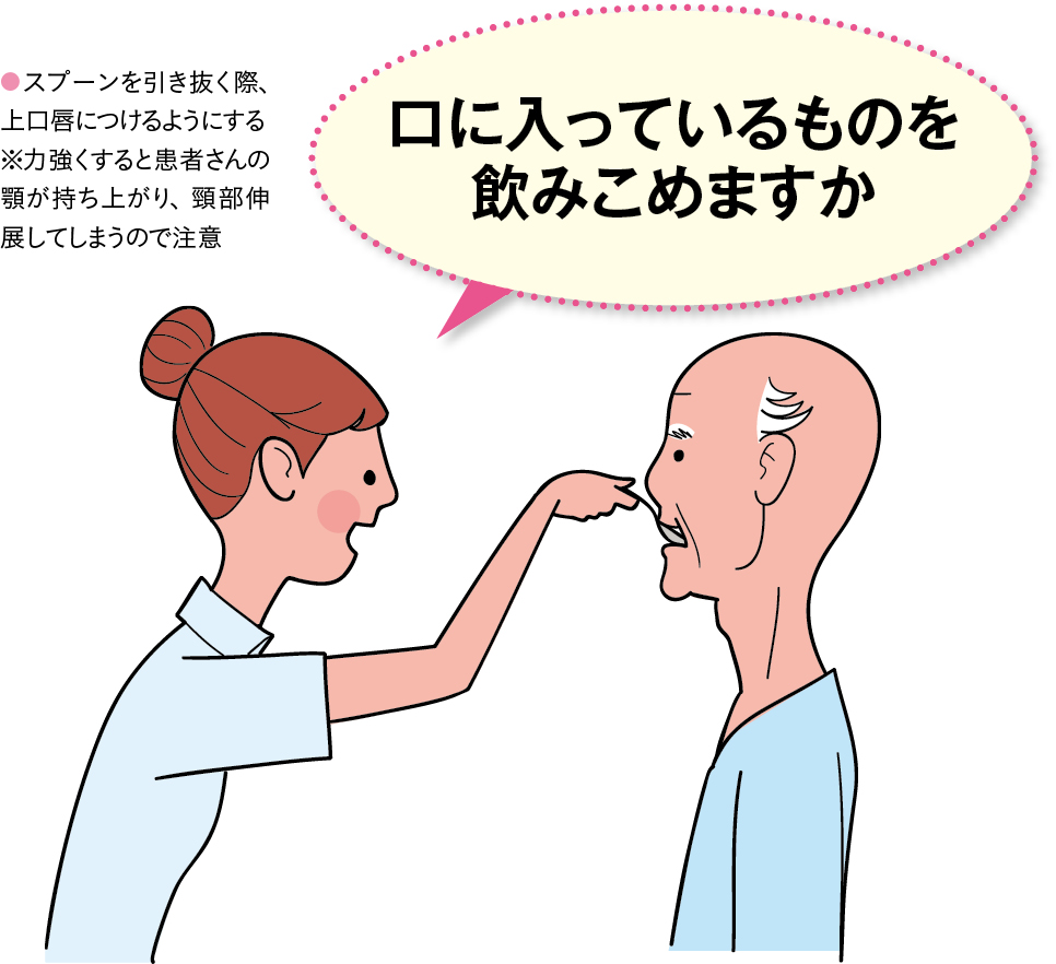 口唇閉鎖の促す食事介助のイラスト