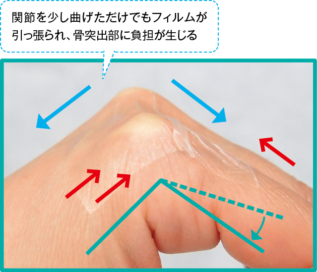 関節にフィルム材を貼付する場合の注意点