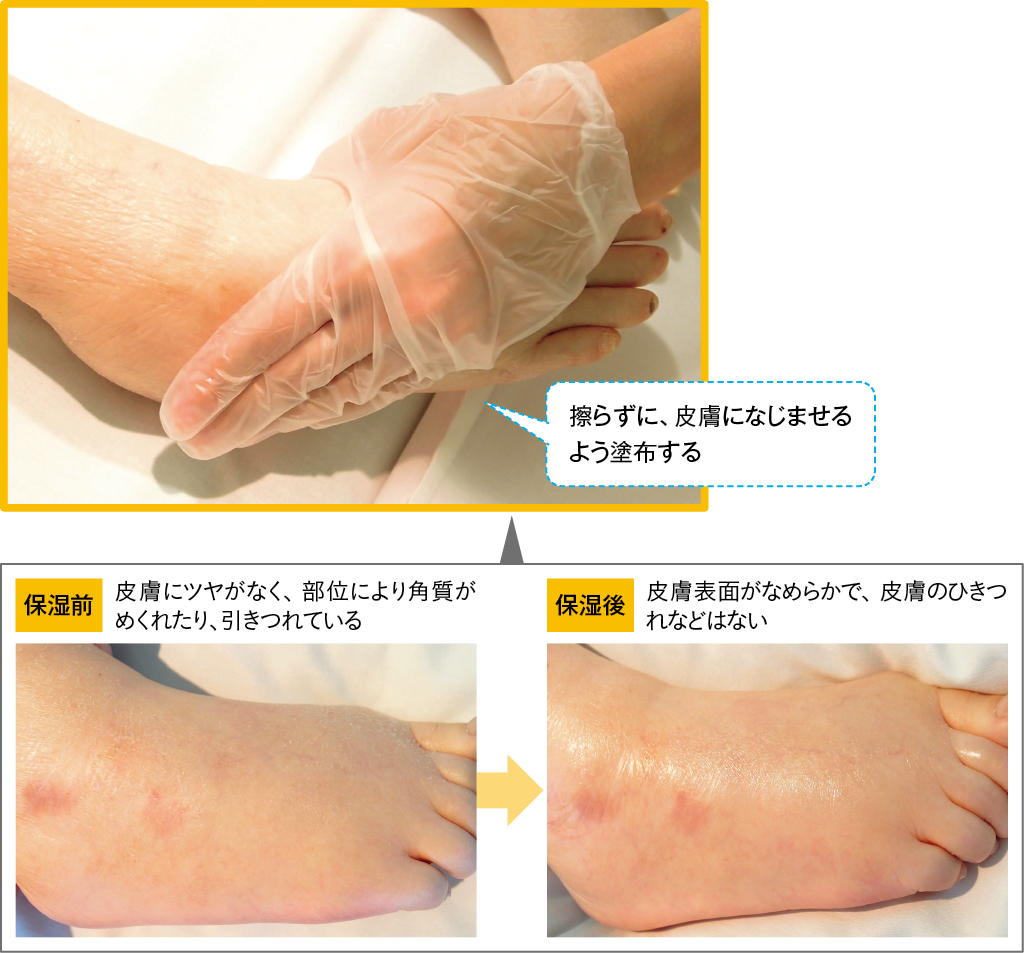 保湿のしかたとその効果