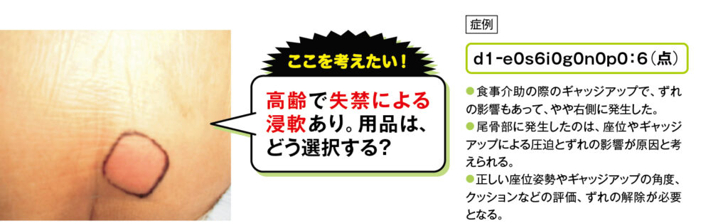 高齢で失禁による新案