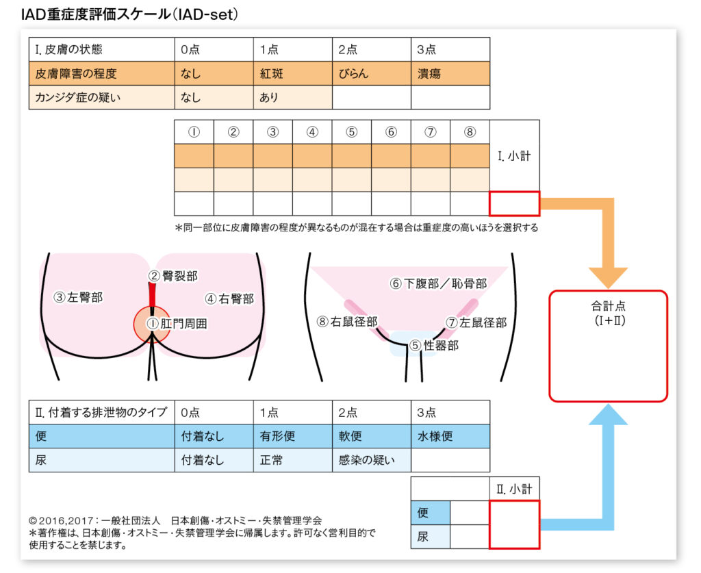 IAD重症度評価スケール（IAD-set）