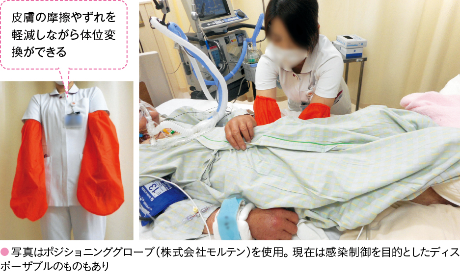 ポジショニンググローブの装着と仕様の実際