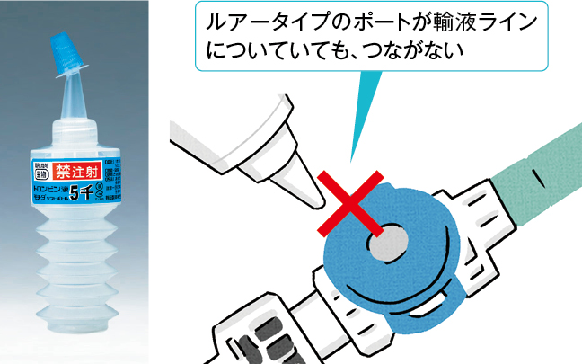トロンビン液の製品例と注意点