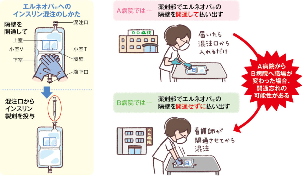 インスリン製剤を高カロリー輸液のエルネオパ®に混注する場合のイラスト