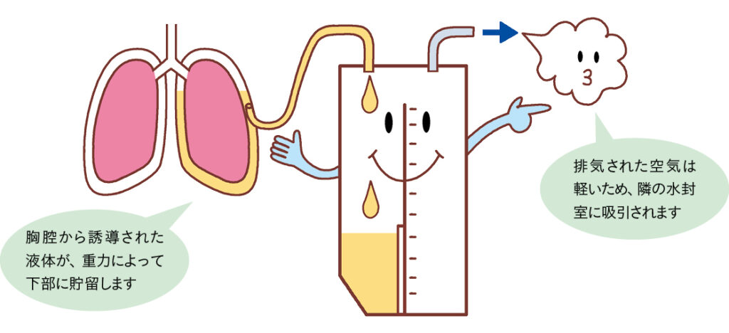 排液室の管理のポイント