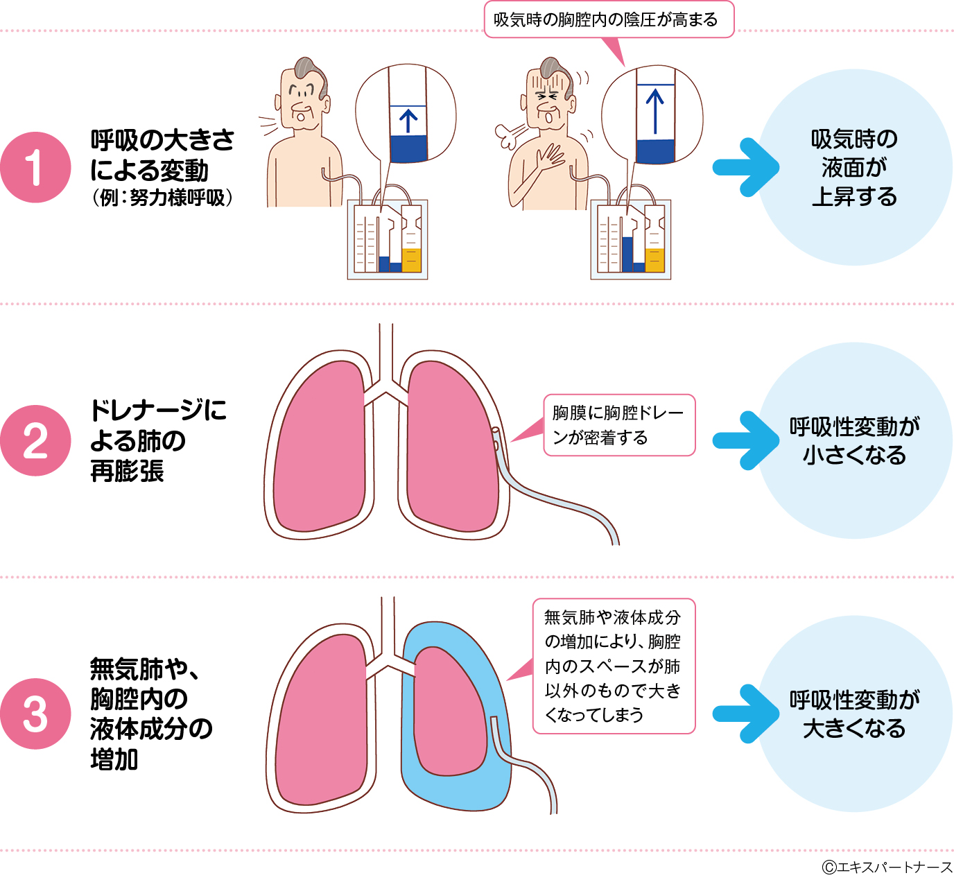 呼吸性変動を変化させる3つの要因