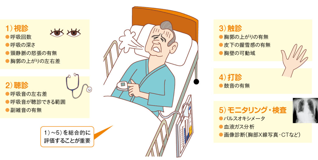 呼吸状態の観察