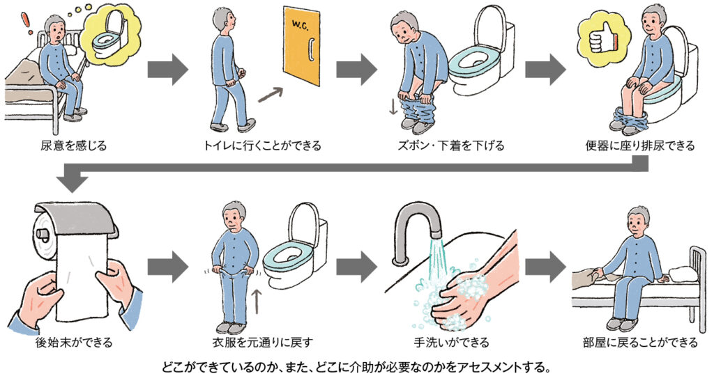 排泄動作のアセスメントのための観察ポイント