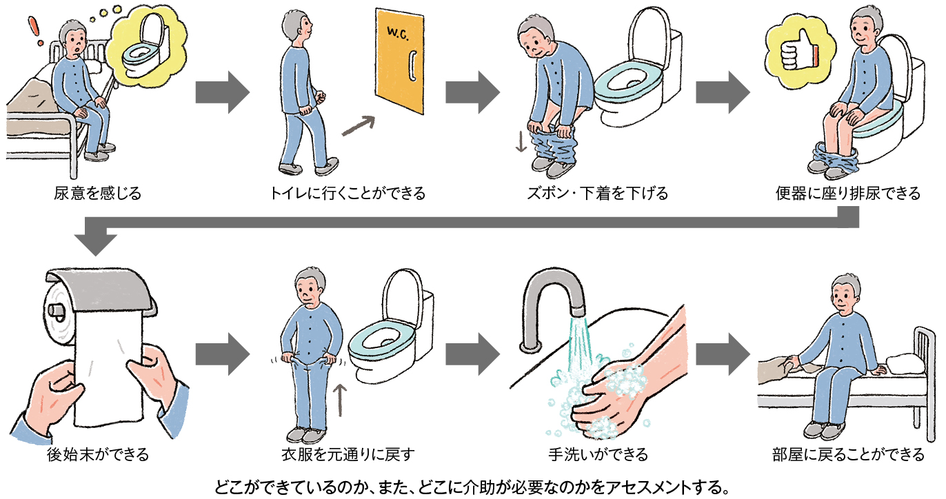 排泄動作のアセスメントのための観察ポイント