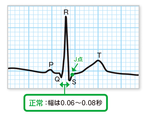 QRS時間（間隔）