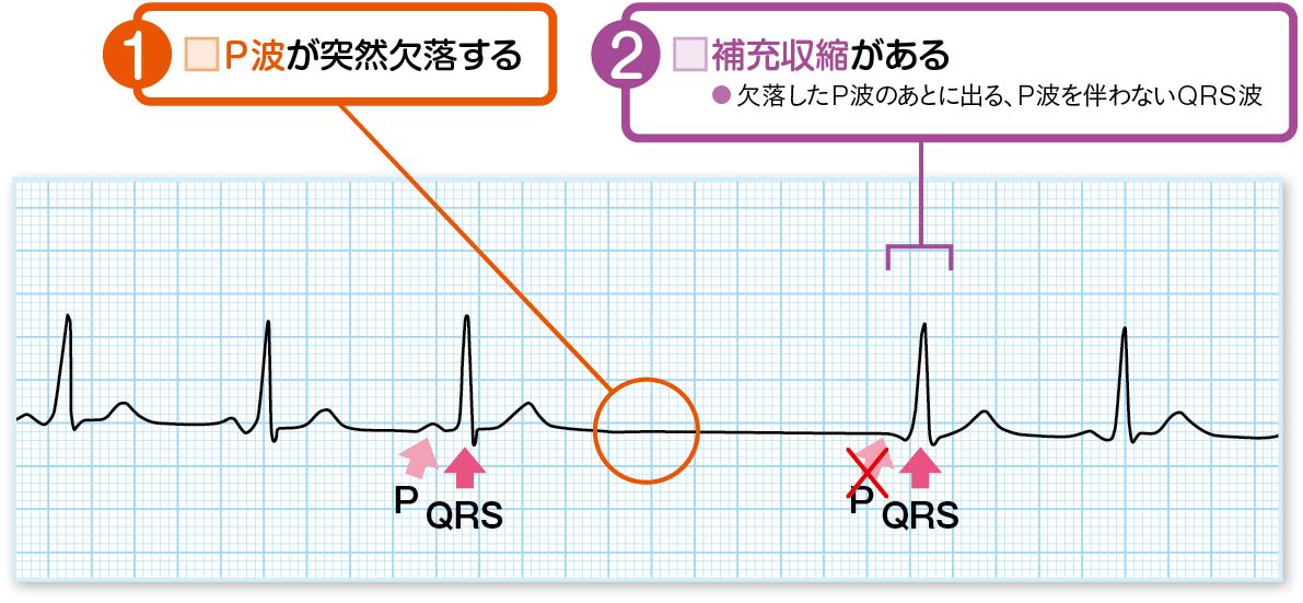 洞不全症候群の読み方のポイント
