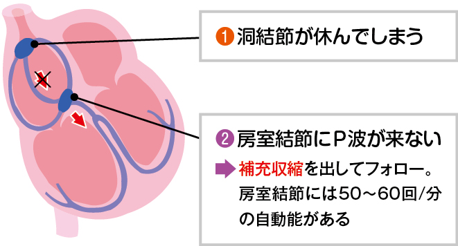 洞不全症候群の読み方のポイント2