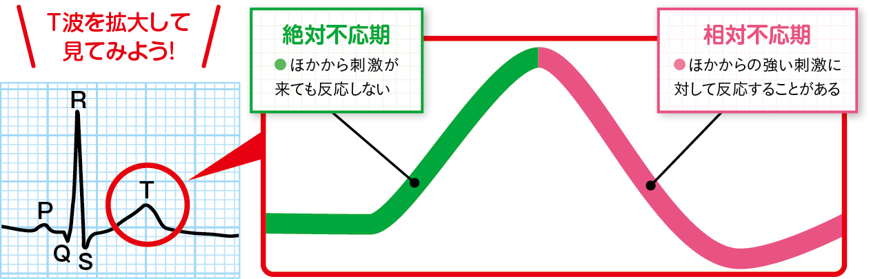 不規則な波形