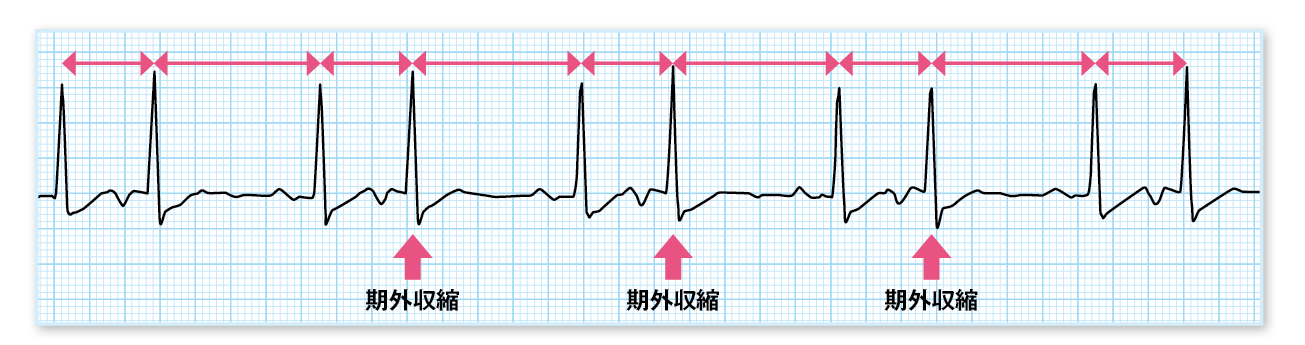 二段脈