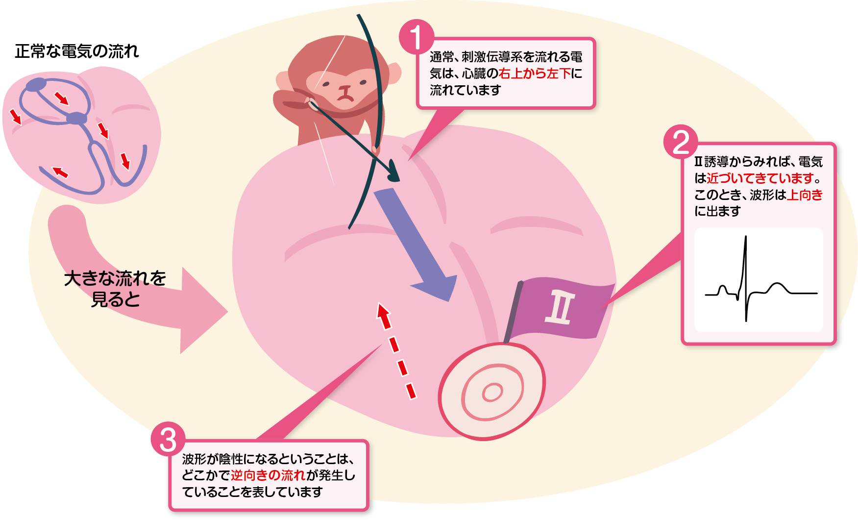 陰性化のメカニズム