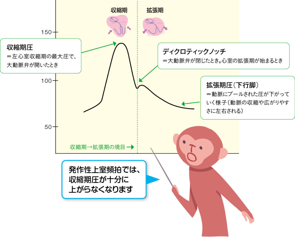 モニター上の動脈圧のみかたを説明するグラフ