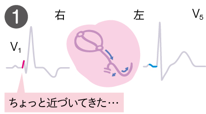 心臓にはこんなことが起きている１