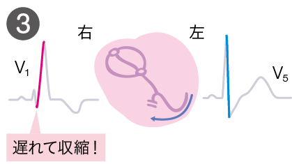 心臓にはこんなことが起きている３