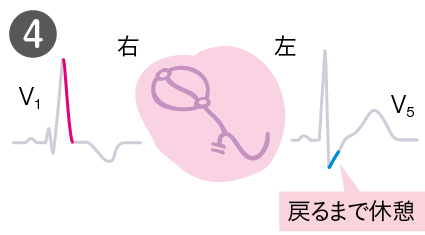 心臓にはこんなことが起きている４