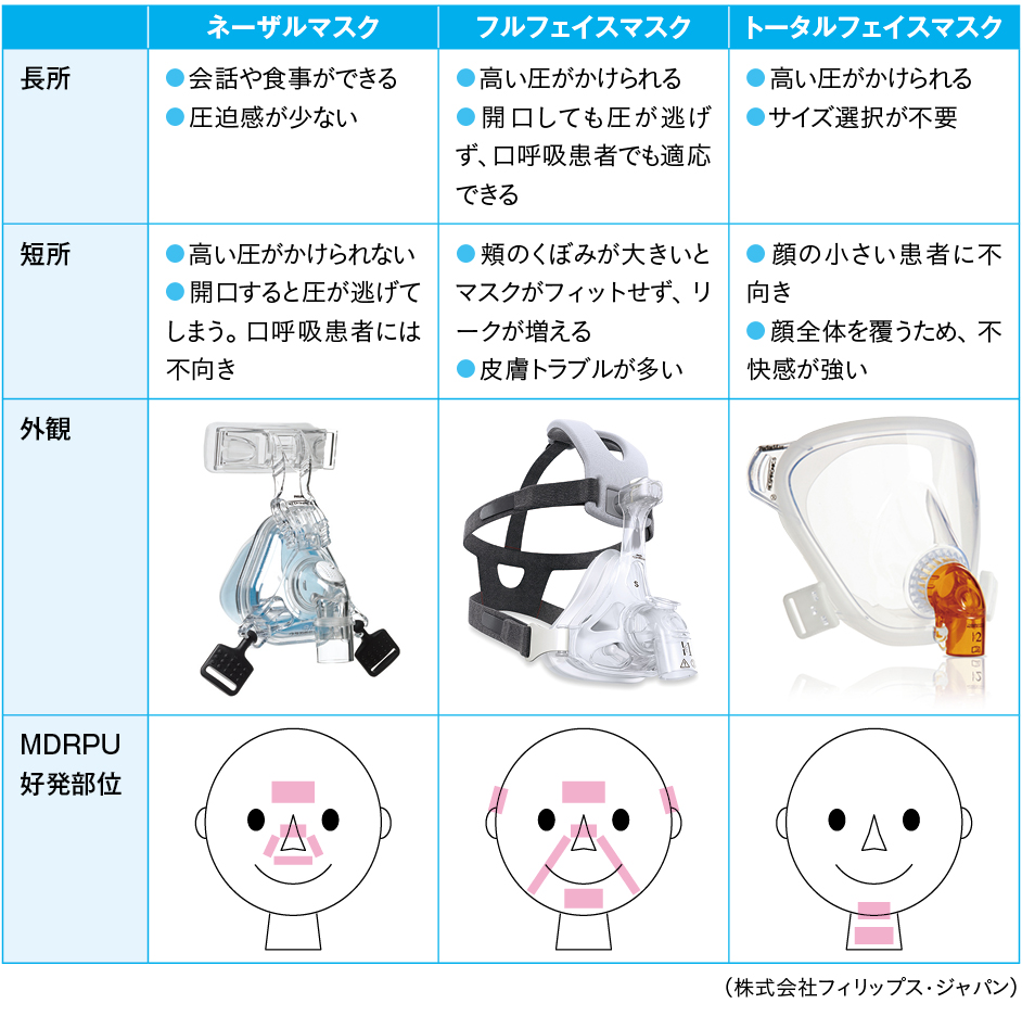 主なマスクの種類・特徴とMDRPU好発部位