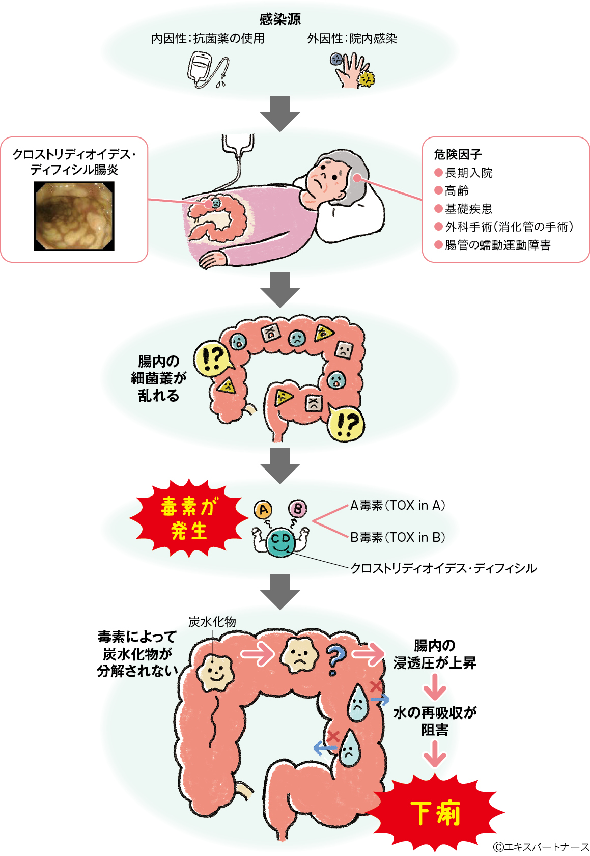 クロストリディオイデス・ディフィシル腸炎で下痢が生じるしくみ