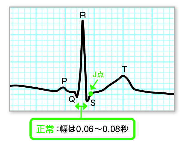 QRS時間(間隔)