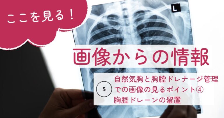 画像からの情報５留置したドレーンサムネイル