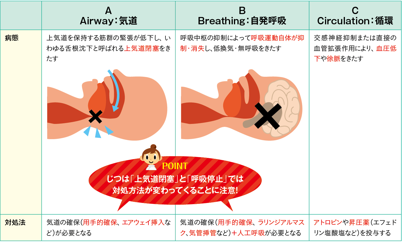 鎮静の合併症の病態と対処方法