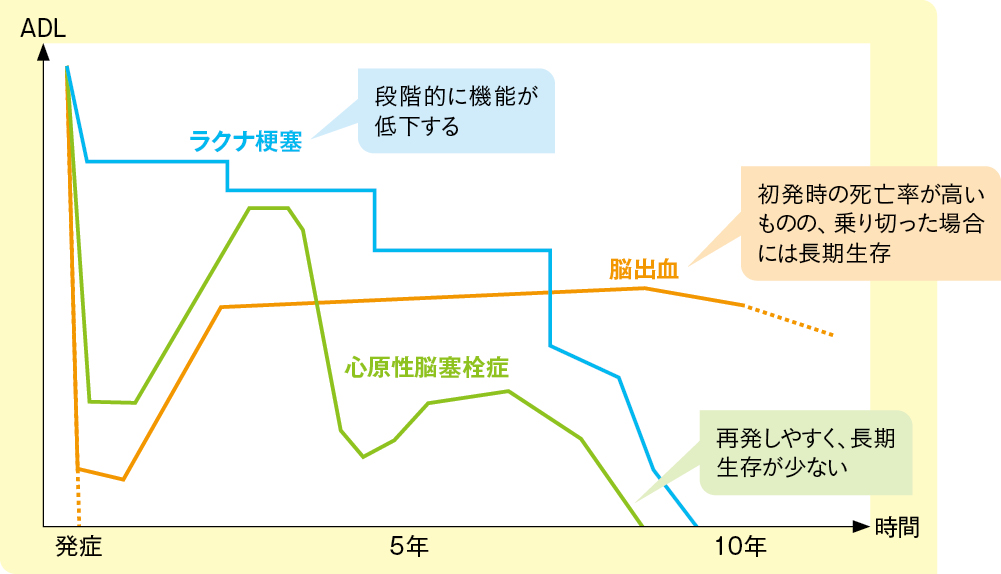 図1　脳卒中の種類による経過の違い