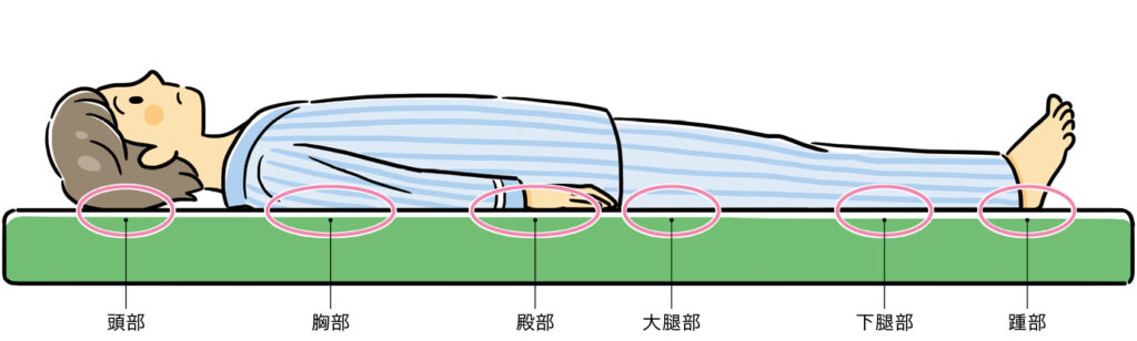 図1　臥床時に身体の重さがかかる部分