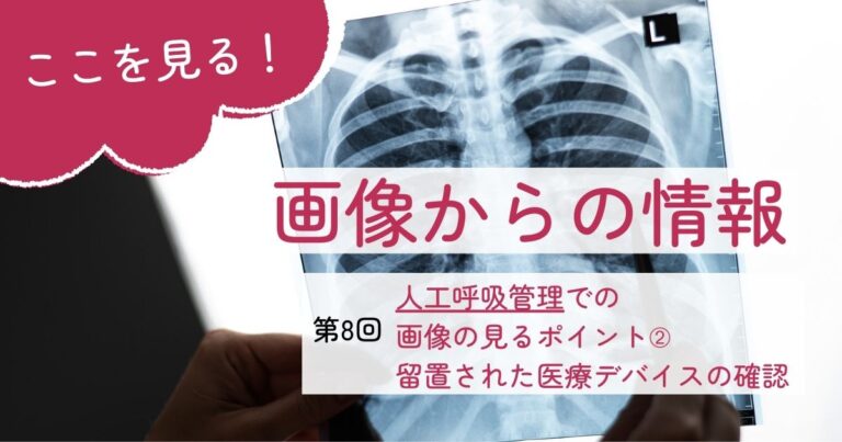 画像からの情報8留置された医療デバイスの確認サムネイル