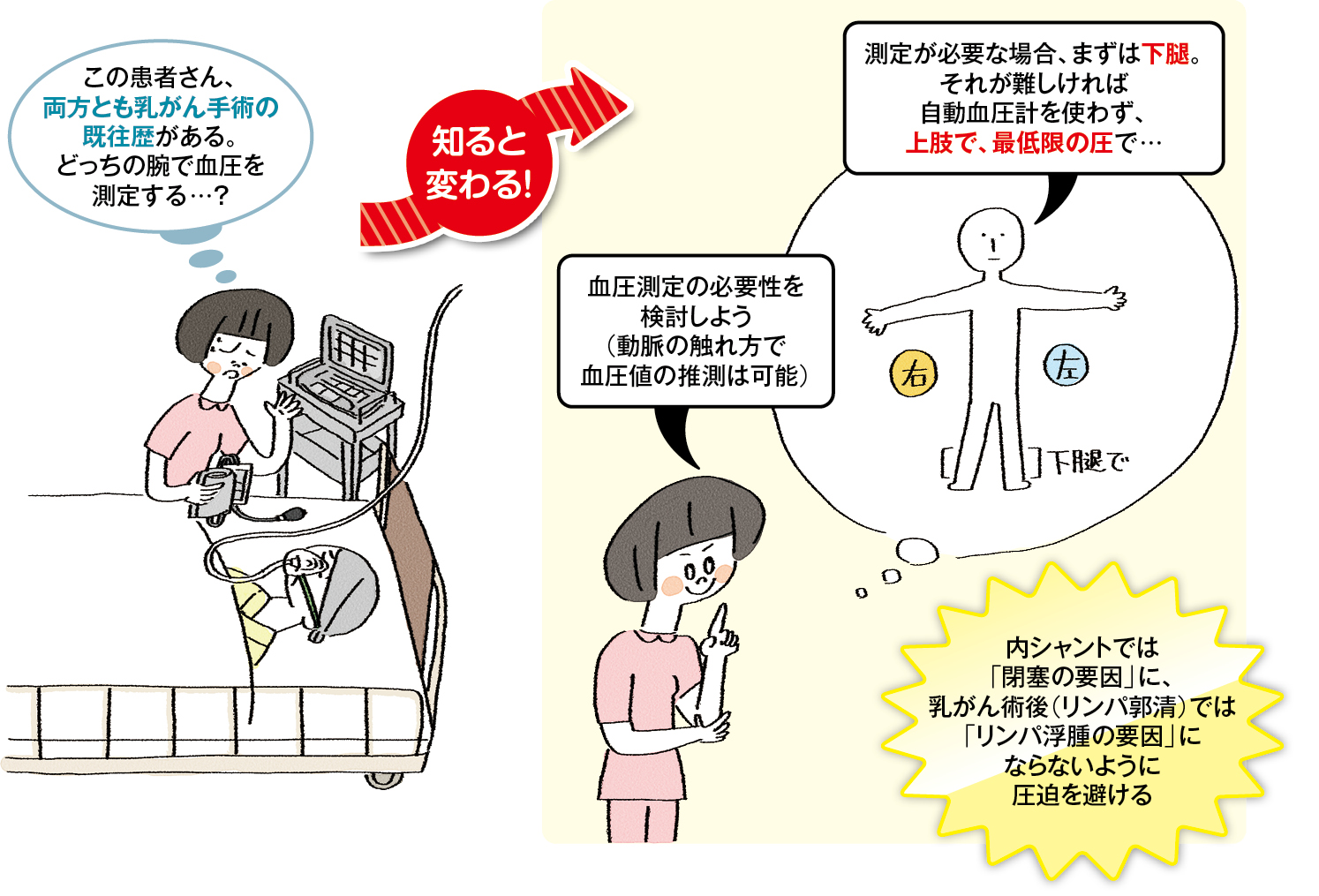 乳がん術後の血圧測定についてのイラスト