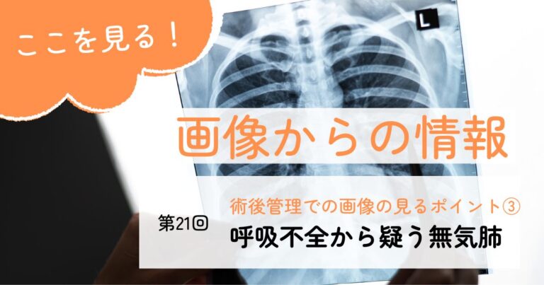 画像からの情報21無気肺サムネイル