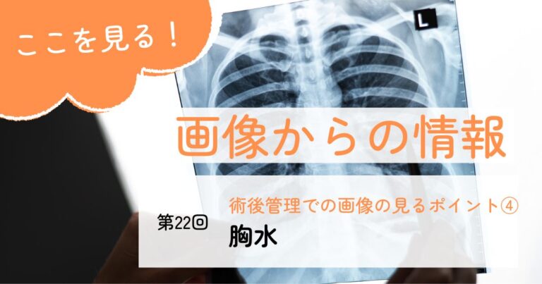 画像からの情報22胸水