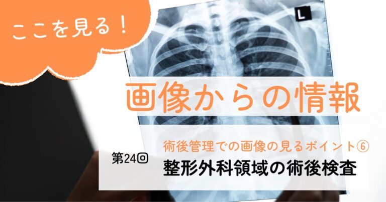 画像からの情報24整形外科領域の術後