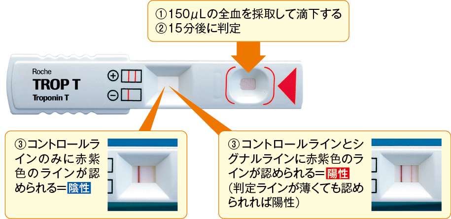 トロップT センシティブ