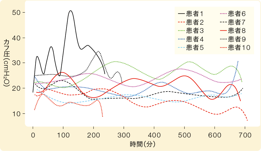 カフ圧の経時的変化