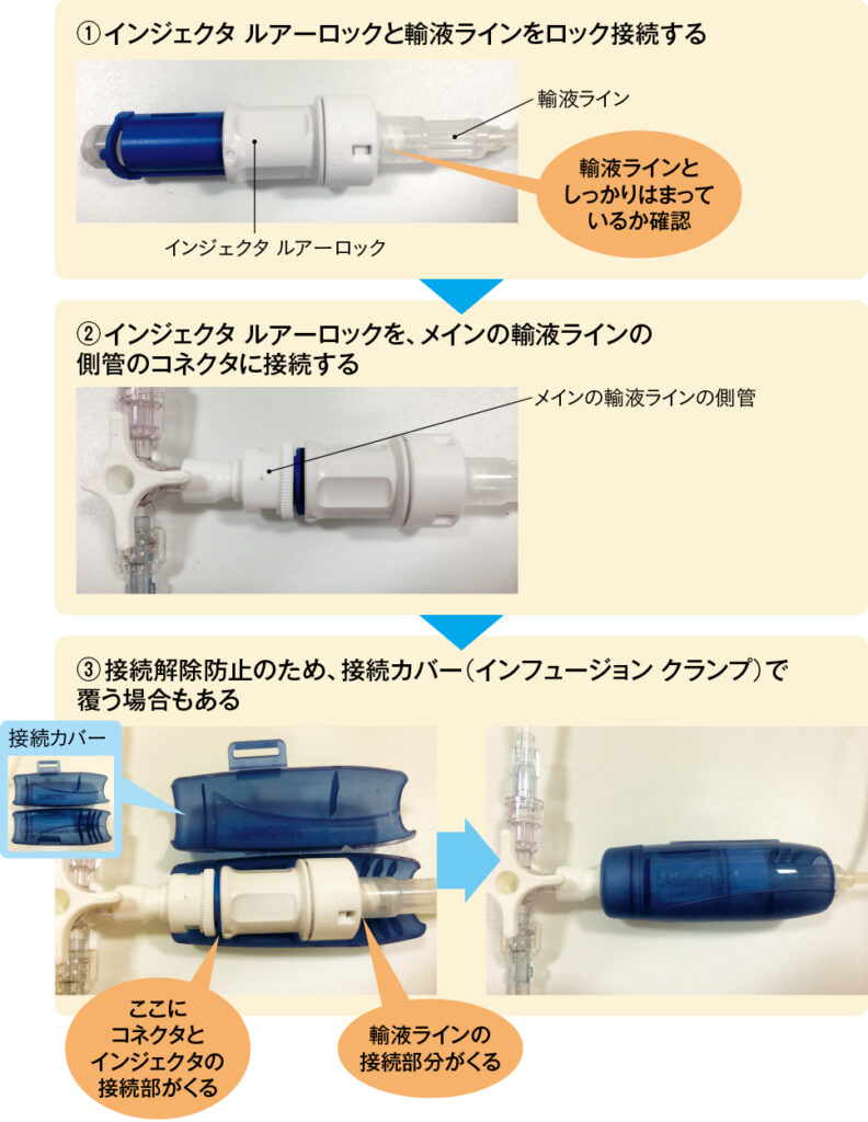 BD ファシール™インジェクタ ルアーロックの接続方法