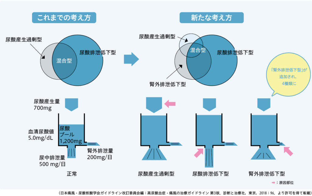 図1　高尿酸血症の病型分類