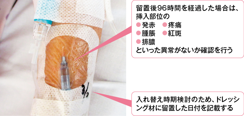 図1 末梢留置カテーテル関連血流感染症対策として行えること