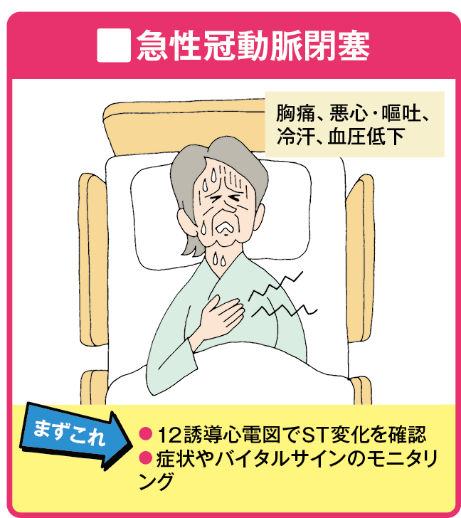 急性冠動脈閉塞