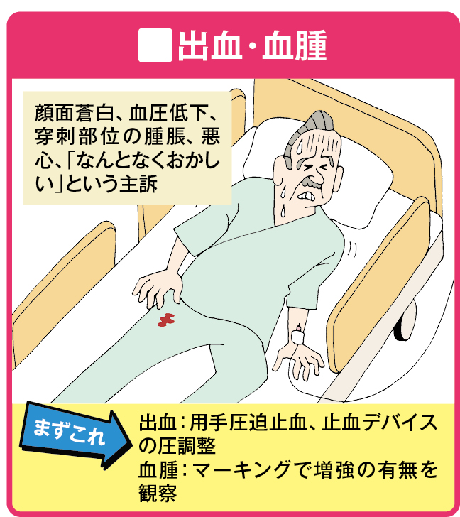 出血・血腫