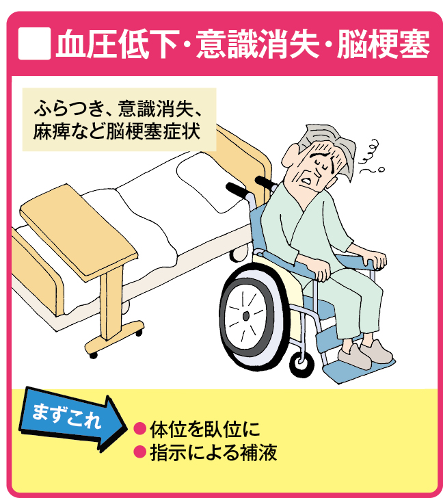 血液透析後の血圧低下・意識消失・脳梗塞