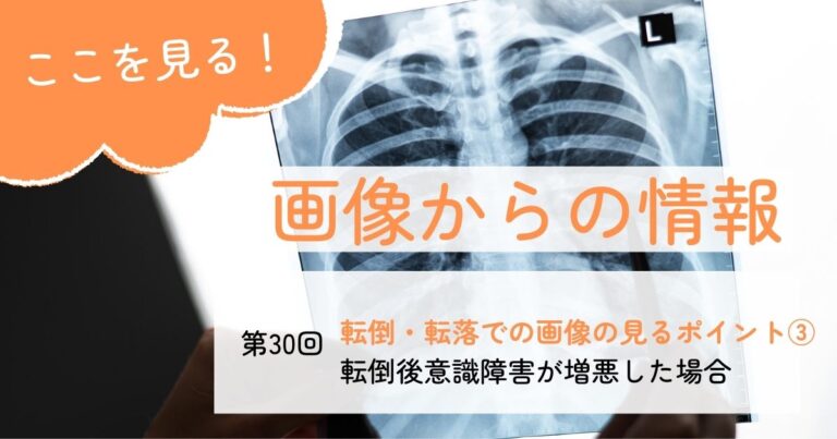 画像からの情報30急性硬膜外血腫