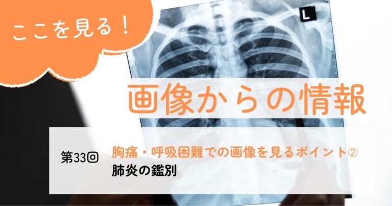 画像からの情報33肺炎サムネイル