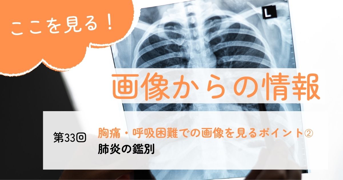 肺炎の画像診断と最新の診療 画像診断2023年増刊号Vol.43 No.4: 胸部X線診断再入門 -症例から