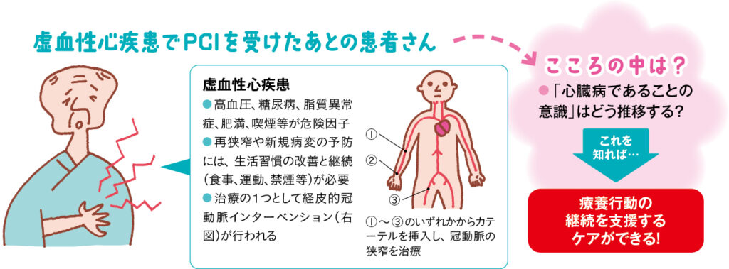 PCI後の患者さん