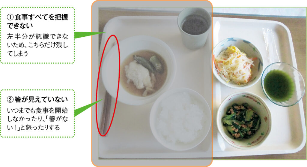 図1 左半側空間無視の患者が認識している食膳のイメージ